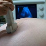 子宮外妊娠とは